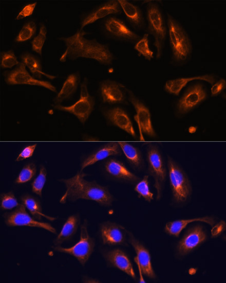 Immunofluorescence analysis of U-2 OS cells using MLPH antibody  at dilution of 1:100