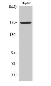 Western blotting validation for Anti-Collagen alpha-6(IV) chain COL4A6 Antibody A06082-1
Western Blot (WB) analysis of specific cells using COL4A6 polyclonal antibody
