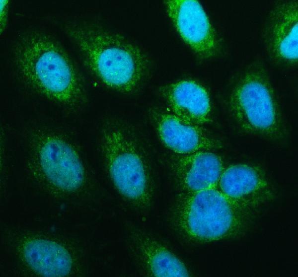 a06085 1 stx17 primary antibodies if testing 1