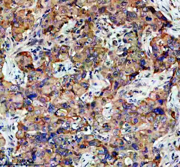 IHC analysis of STX17 using anti-STX17 antibody (A06085-1)
