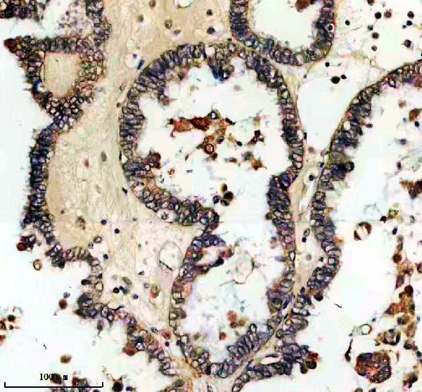 IHC analysis of STX17 using anti-STX17 antibody (A06085-1)