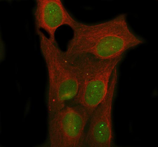 a06087 1 nova1 primary antibodies if testing 11