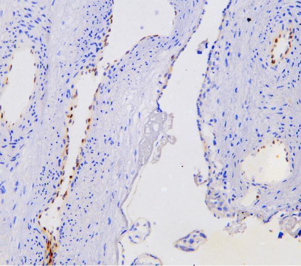 a06087 1 nova1 primary antibodies ihc testing 10