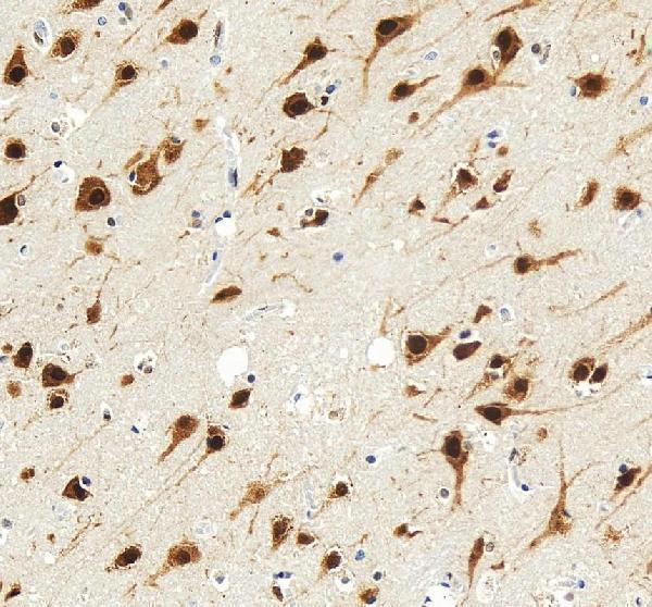 a06087 1 nova1 primary antibodies ihc testing 11