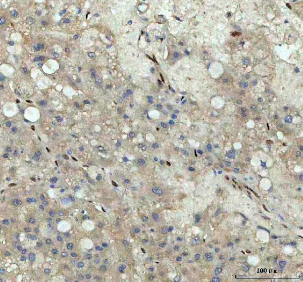 a06087 1 nova1 primary antibodies ihc testing 4