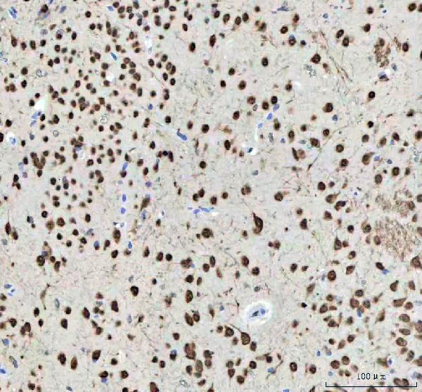 a06087 1 nova1 primary antibodies ihc testing 6