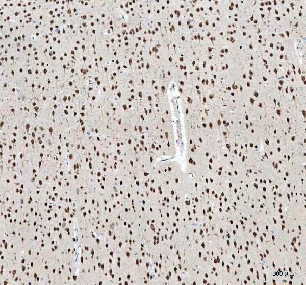 a06087 1 nova1 primary antibodies ihc testing 8