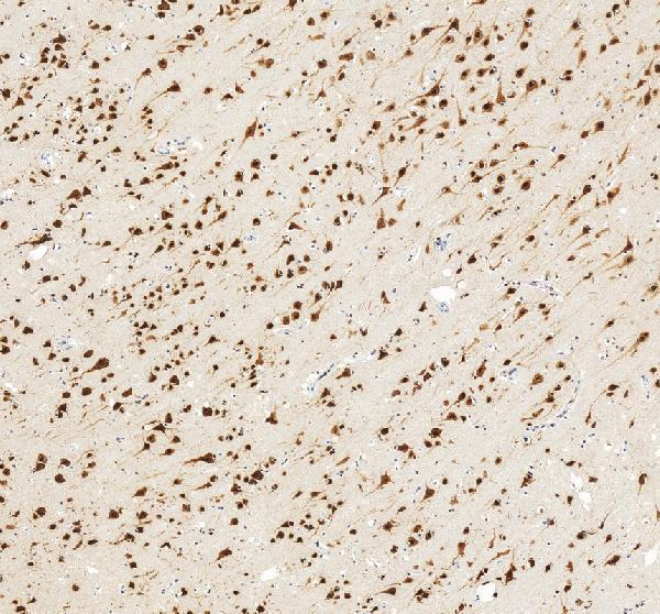 a06087 1 nova1 primary antibodies ihc testing 9_1