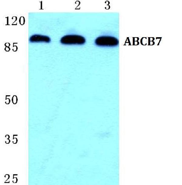 Western blot (WB) analysis of ABCB7 polyclonal antibody at 1:500 dilution
Lane1:Hela cell lysate
Lane2:Raw264