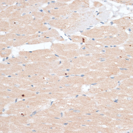 Immunohistochemistry of paraffin-embedded rat heart using ABCB7 antibody  at dilution of 1:100 
