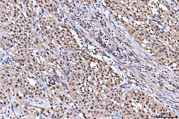  IHC analysis of NUB1 using anti-NUB1 antibody (A06089-2)