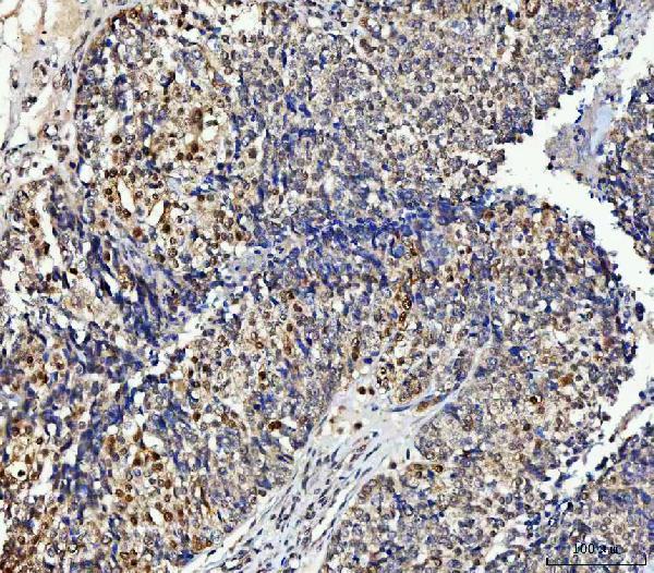a06089 2 nub1 primary antibodies ihc testing 4