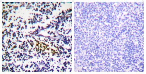 Immunohistochemistry analysis of paraffin-embedded human tonsil tissue, using NYREN18 Antibody