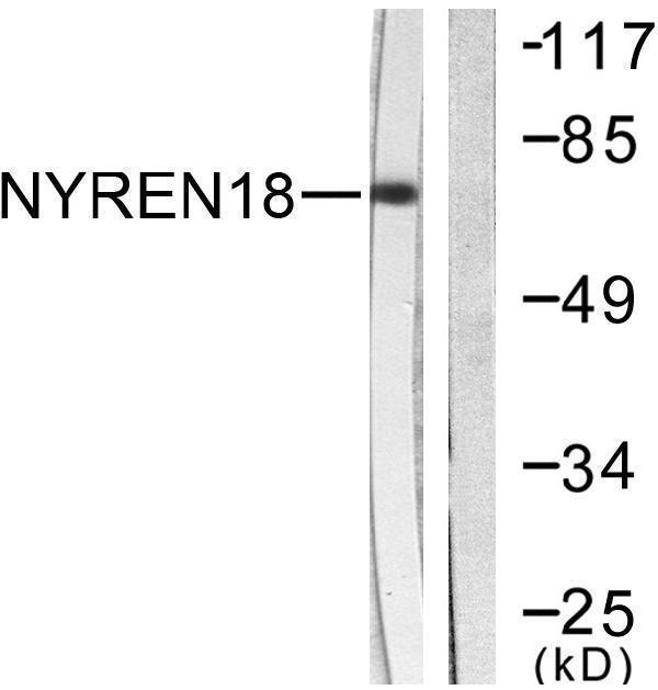 Western blot analysis of lysates from COS7 cells, using NYREN18 Antibody