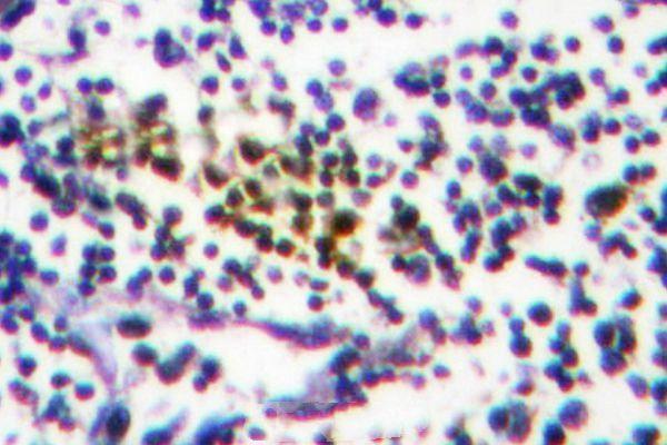 a06089y601 nub1 primary antiboties ihc testing 2