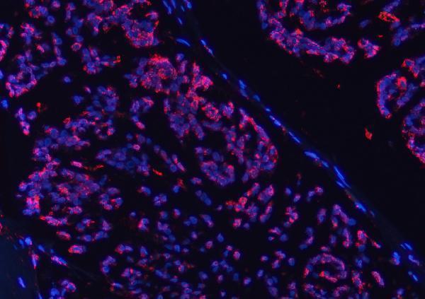 a06090 2 cox5b primary antibodies if testing 17
