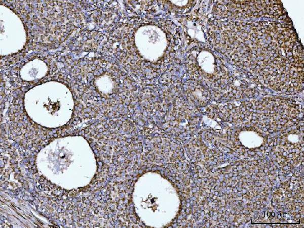  IHC analysis of COX5B using anti-COX5B antibody (A06090-2)