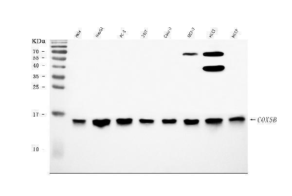  Western blot analysis of COX5B using anti-COX5B antibody (A06090-2)