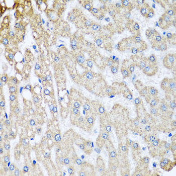 Immunohistochemistry of paraffin-embedded human colon using COX5B Rabbit pAb  at dilution of 1:100 