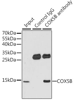 Immunohistochemistry of paraffin-embedded mouse kidney using COX5B Rabbit pAb  at dilution of 1:100 