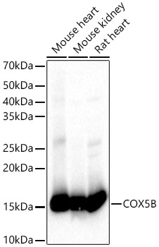 Western blot analysis of various lysates, using COX5B antibody  at 1:1320 dilution