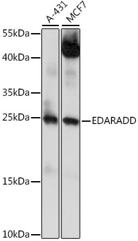 a06091 edaradd primary antiboties wb testing 1