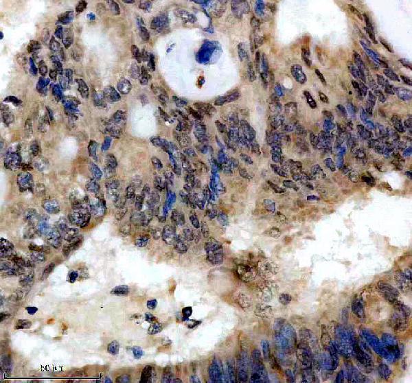 IHC analysis of SRSF5 using anti-SRSF5 antibody (A06095-2)
