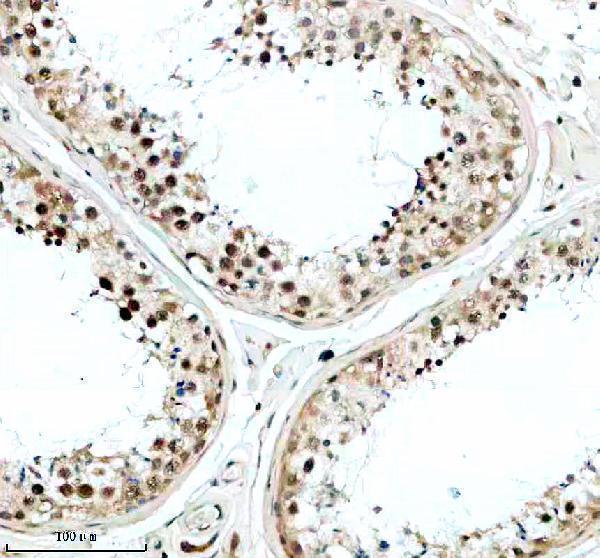 IHC analysis of SRSF5 using anti-SRSF5 antibody (A06095-2)