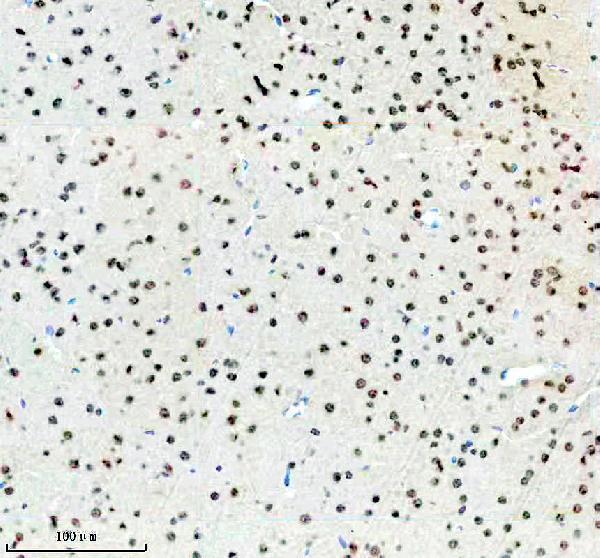 a06095 2 srsf5 primary antibodies ihc testing 3