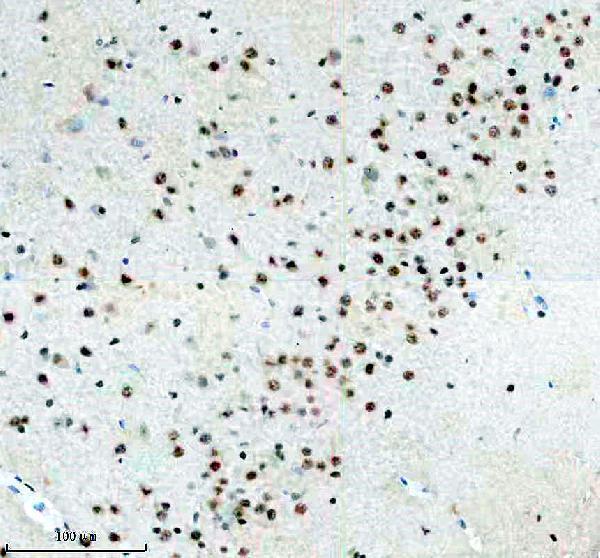 a06095 2 srsf5 primary antibodies ihc testing 4