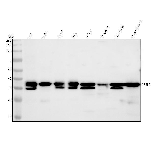 Western blot analysis of SRSF5 using anti-SRSF5 antibody (A06095-2)
