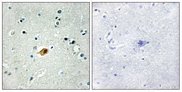Immunohistochemistry analysis of paraffin-embedded human brain tissue, using SOX8/9/17/18 Antibody