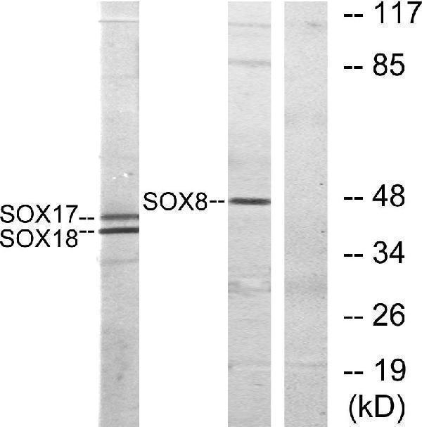 Western blot analysis of lysates from COS7 cells, treated with serum 10% 30', using SOX8/9/17/18 Antibody
