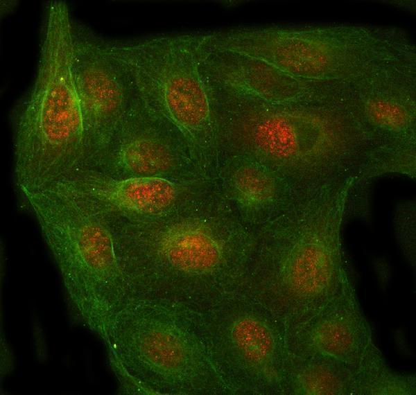 a06099 1 psmc4 primary antibodies if testing 7