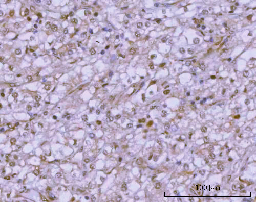  IHC analysis of PSMC4 using anti-PSMC4 antibody (A06099-1)