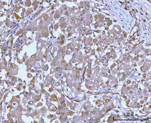  IHC analysis of PSMC4 using anti-PSMC4 antibody (A06099-1)