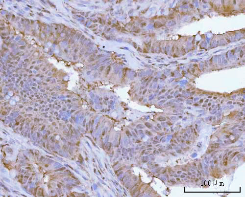 a06099 1 psmc4 primary antibodies ihc testing 4