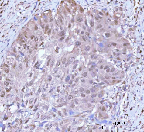 a06099 1 psmc4 primary antibodies ihc testing 5