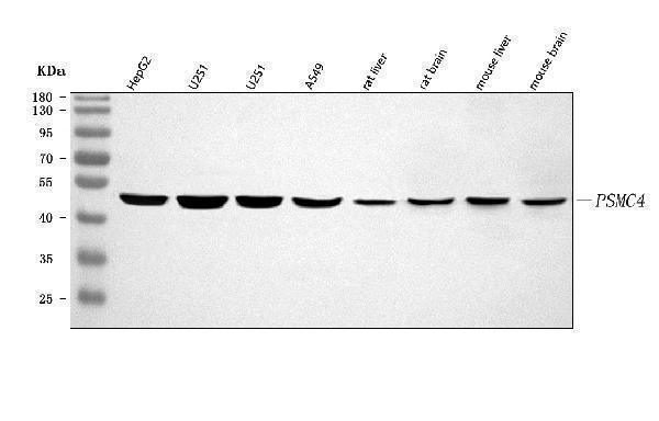  Western blot analysis of PSMC4 using anti-PSMC4 antibody (A06099-1)