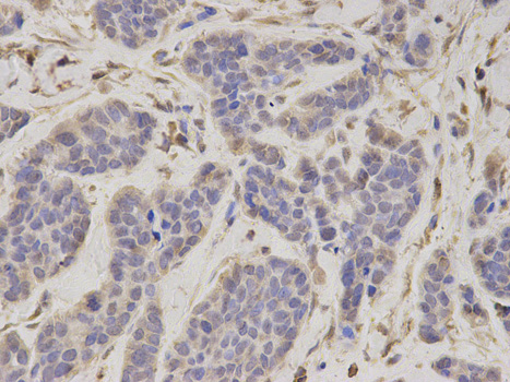 a06099 psmc4 primary antiboties if testing 2