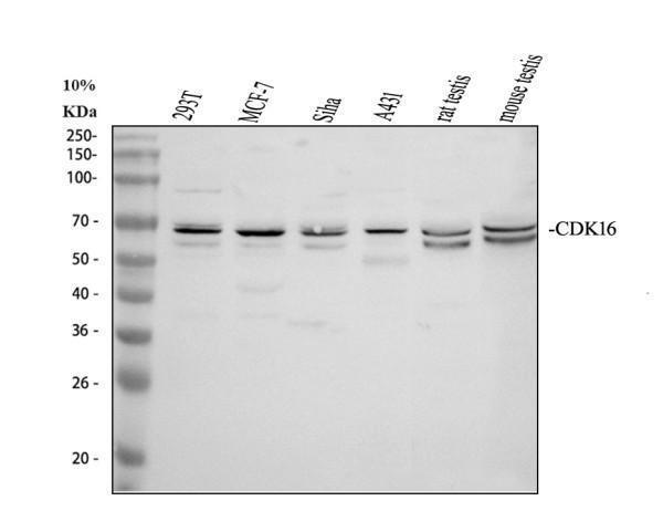 Western blot analysis of PCTAIRE1/CDK16 using anti-PCTAIRE1/CDK16 antibody (A06102-1)