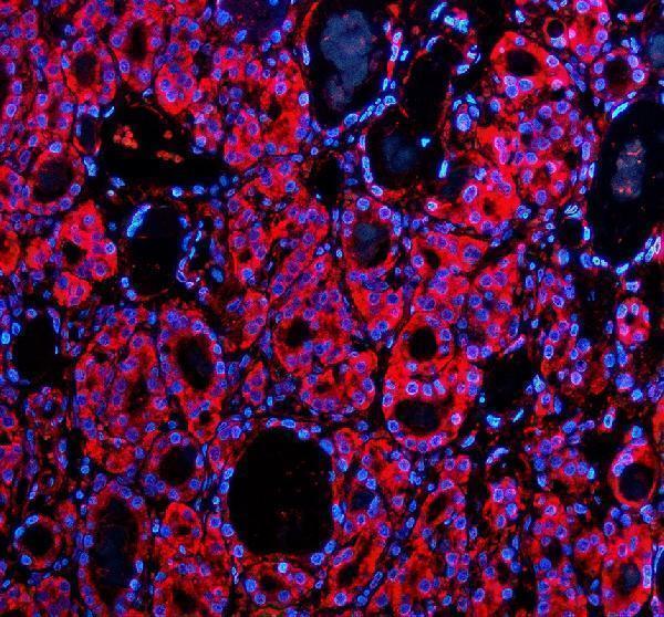 a06103 2 gfra2 primary antibodies if testing 2