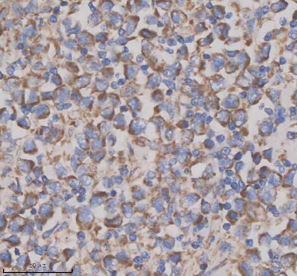 IHC analysis of GFRA2 using anti-GFRA2 antibody (A06103-2)