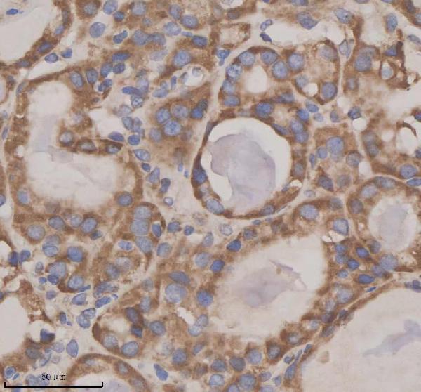 IHC analysis of GFRA2 using anti-GFRA2 antibody (A06103-2)