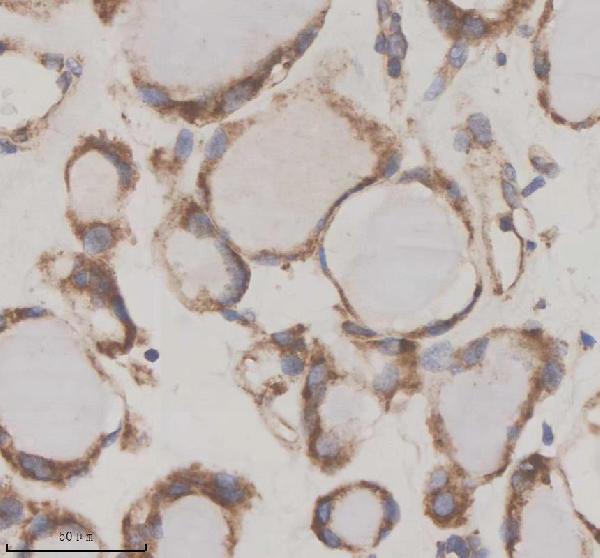a06103 2 gfra2 primary antibodies ihc testing 3