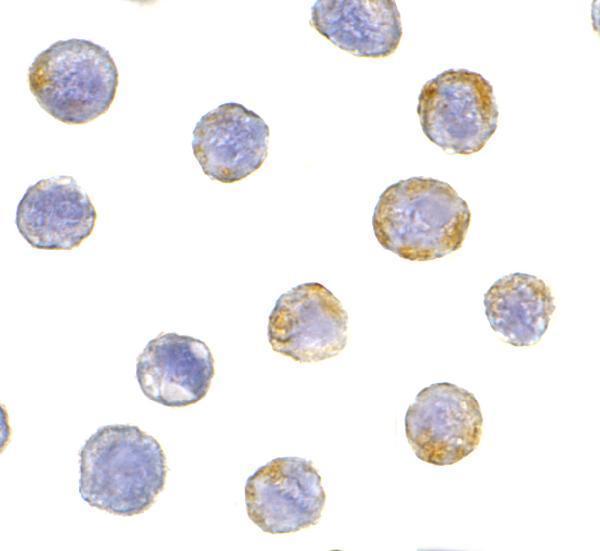 Immunocytochemistry of GFR alpha 2 in HeLa cells with GFR alpha 2 antibody at 5 μg/mL