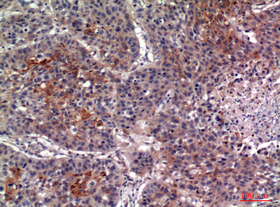 a06105 1 il13ra2 primary antibodies ihc testing 1