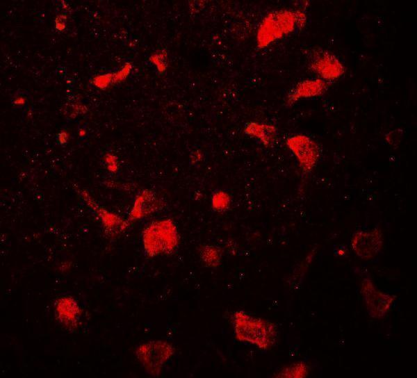 Immunofluorescence of OLIG1 in human brain tissue with OLIG1 antibody at 20 μg/mL