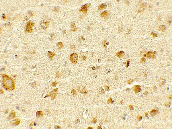 Immunohistochemistry of OLIG1 in human brain tissue with OLIG1 antibody at 5 μg/mL