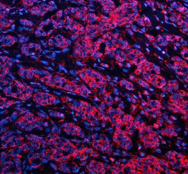 a06112 3 gstk1 primary antibodies if testing 1